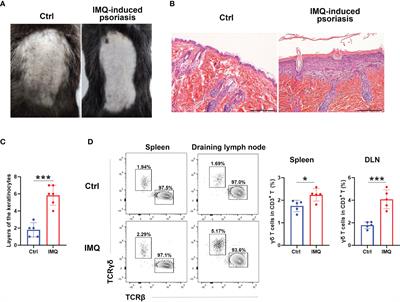 D-Mannose Suppresses γδ T Cells and Alleviates Murine Psoriasis